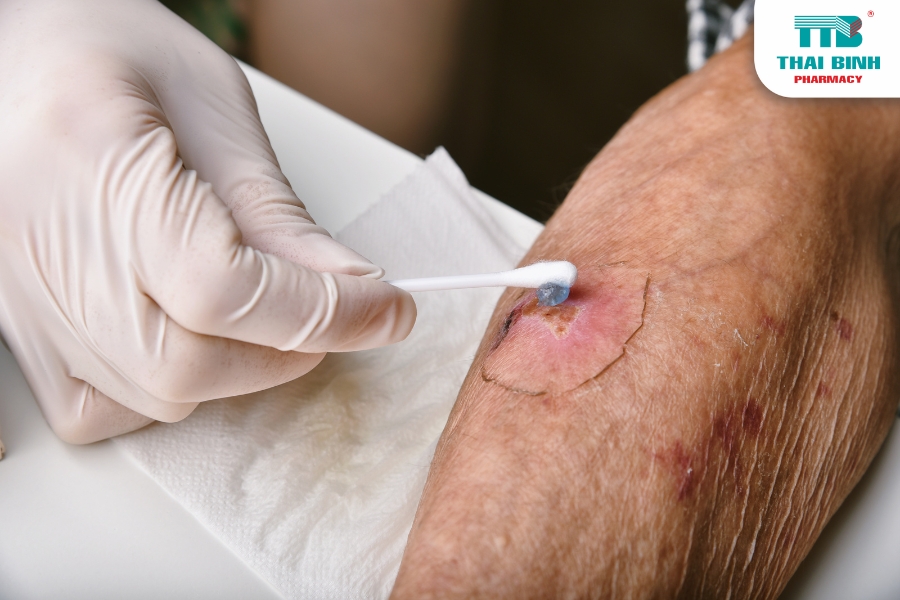 5 Biến Chứng Tiểu Đường Gây Nguy Hiểm Đến Sức Khỏe 