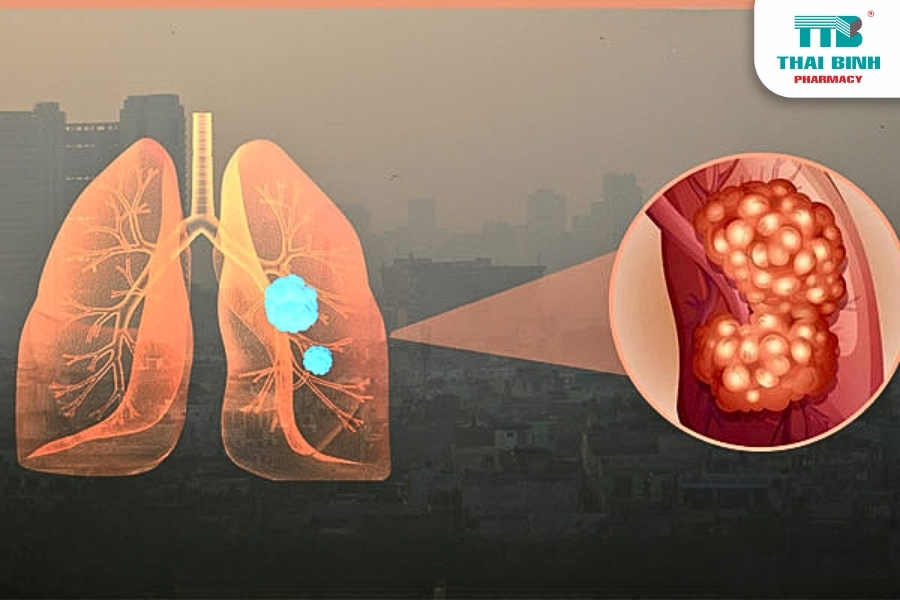 Bảo Vệ Sức Khỏe Trước Tác Động Của Ô Nhiễm Không Khí