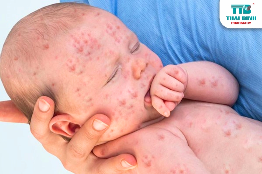 Bí Quyết Ngăn Ngừa Bệnh Truyền Nhiễm Ở Trẻ Em Hiệu Quả