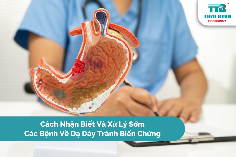 Cách Nhận Biết Và Xử Lý Sớm Các Bệnh Về Dạ Dày Tránh Biến Chứng