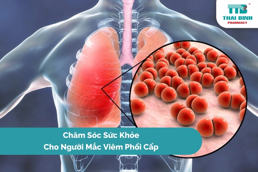 Chăm Sóc Sức Khỏe Cho Người Mắc Viêm Phổi Cấp