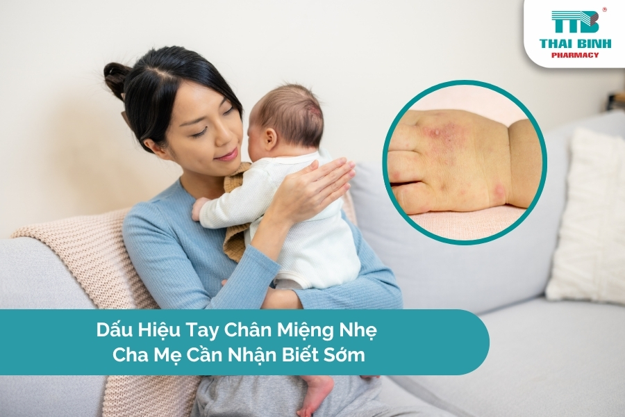 Dấu Hiệu Sớm Của Tay Chân Miệng Mà Cha Mẹ Cần Nhận Biết