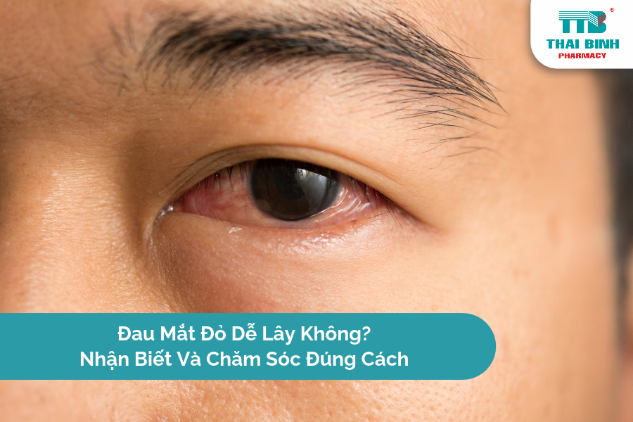 Đau Mắt Đỏ Dễ Lây Không? Nhận Biết Và Chăm Sóc Đúng Cách