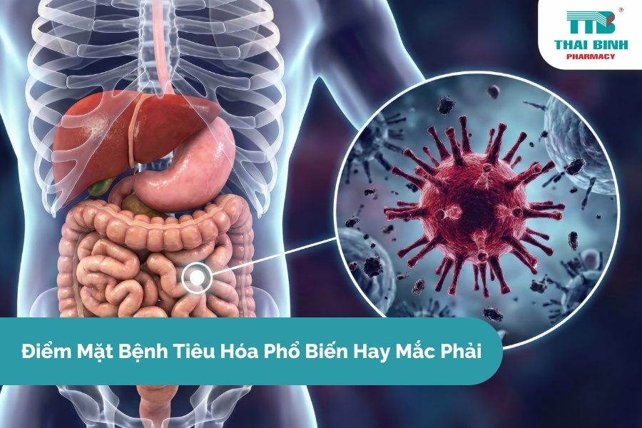 Điểm Mặt Bệnh Tiêu Hóa Phổ Biến Hay Mắc Phải