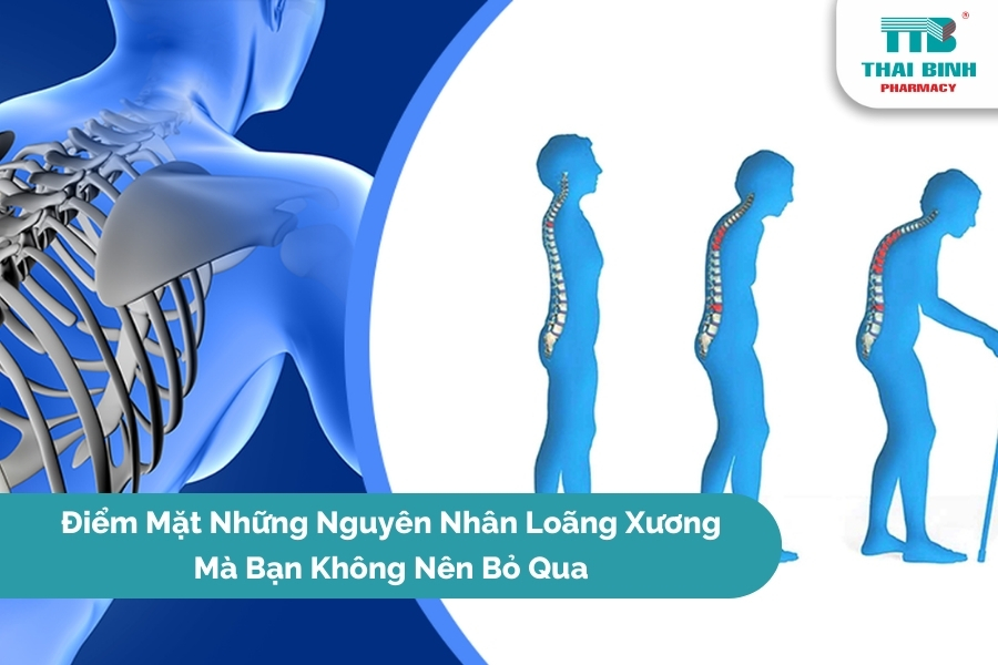 Điểm Mặt Những Nguyên Nhân Loãng Xương Mà Bạn Không Nên Bỏ Qua