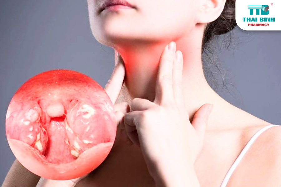 Giải Pháp Cải Thiện Tình Trạng Ho Khan Kéo Dài Hiệu Quả