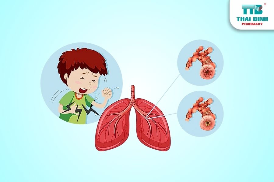 Khám Phá Các Bệnh Thường Gặp Ở Phổi Mà Bạn Cần Biết