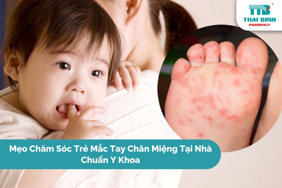 Mẹo Chăm Sóc Trẻ Mắc Tay Chân Miệng Tại Nhà Chuẩn Y Khoa