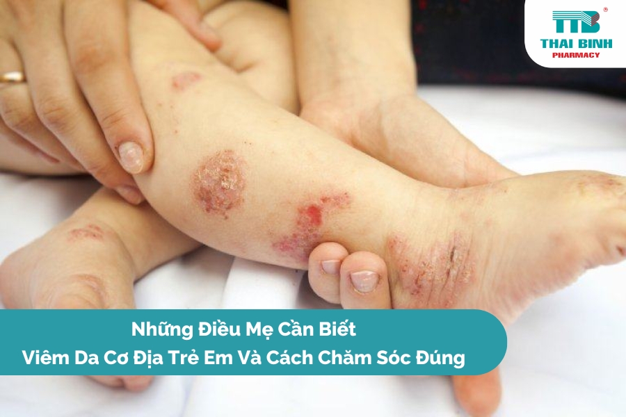 Những Điều Mẹ Cần Biết: Viêm Da Cơ Địa Trẻ Em Và Cách Chăm Sóc Đúng