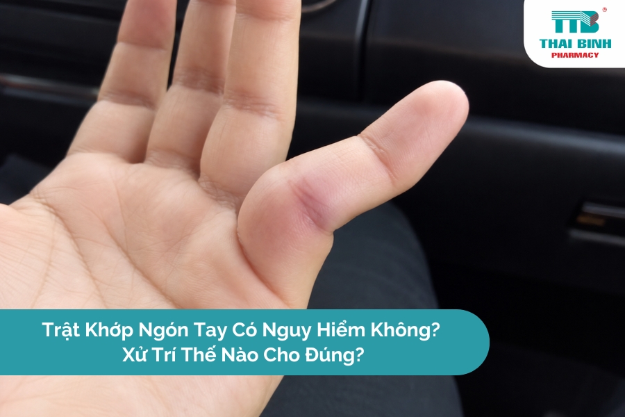 Trật Khớp Ngón Tay Có Nguy Hiểm Không? Xử Trí Thế Nào Cho Đúng?