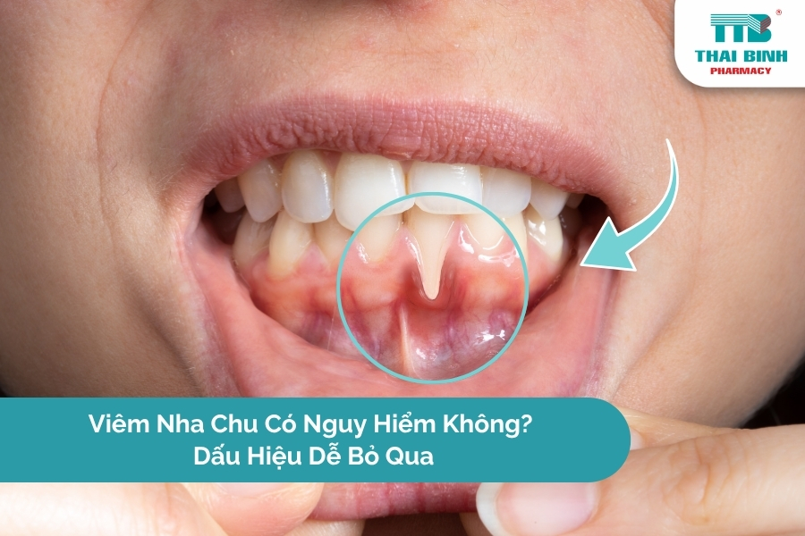 Viêm Nha Chu Có Nguy Hiểm Không? Dấu Hiệu Dễ Bỏ Qua